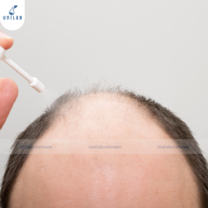Cấu trúc sợi tóc