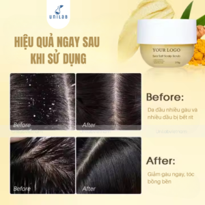 Gia Công Muối Tẩy Tế Bào Chết Da Đầu