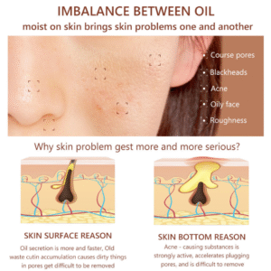 Gia Công Serum Thu Nhỏ Lỗ Chân Lông