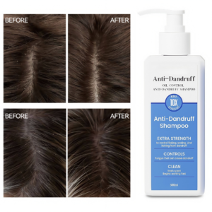 Gia Công Dầu Gội Sạch Gàu