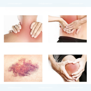 Gia Công Lăn Massage Giảm Đau