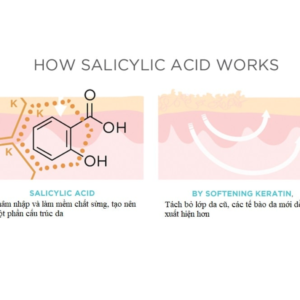 Salicylic Acid