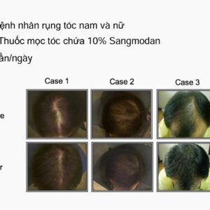 sangmodan