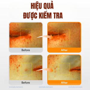 Gia Công Serum Glutathiosome