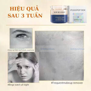 Gia Công Kem Chống Nhăn