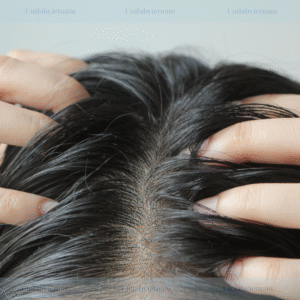 Scalposine™ BC10101