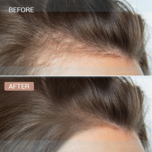 gia công Serum giảm rụng tóc