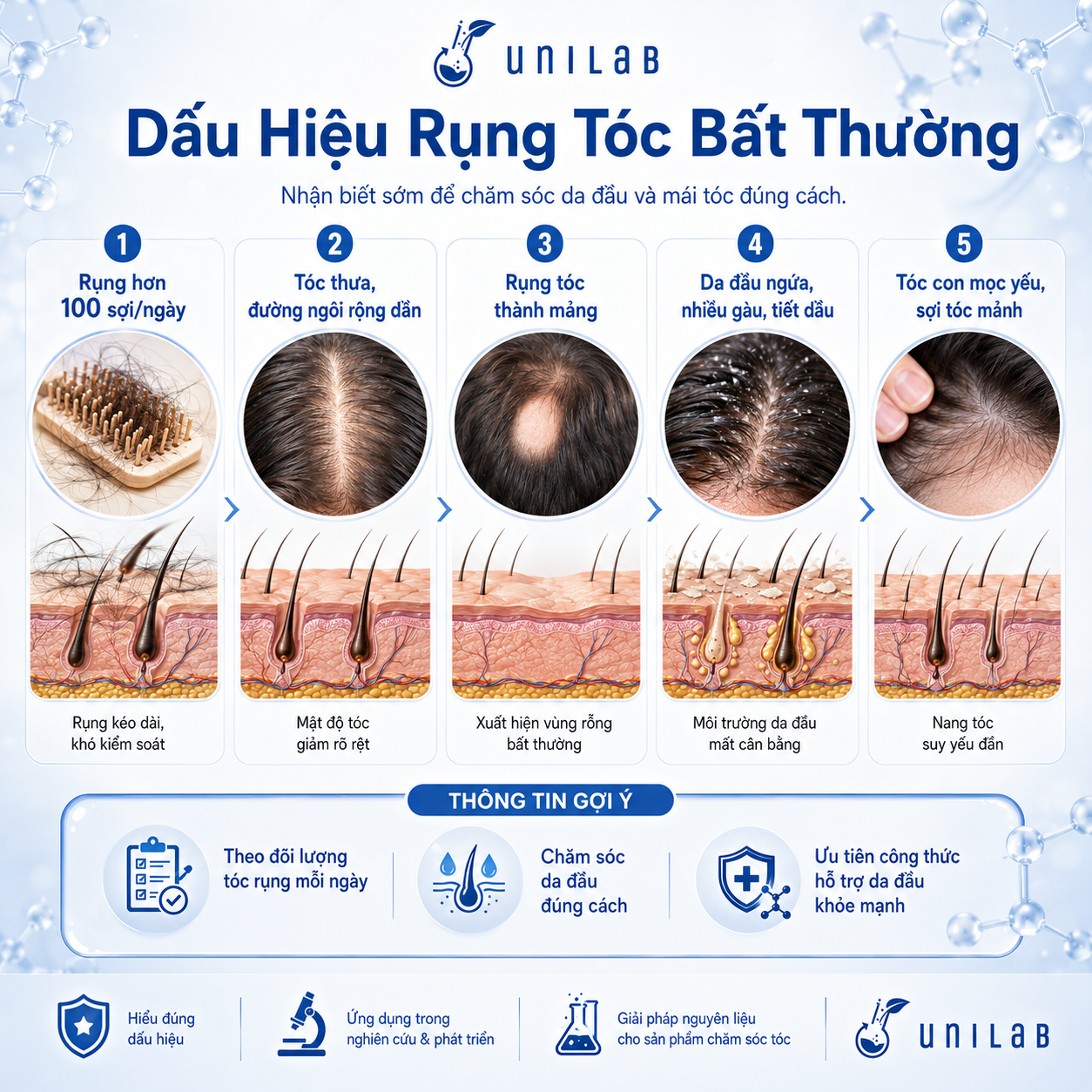 Dấu hiệu rụng tóc bất thường
