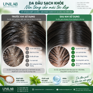Gia công tẩy tế bào chết da đầu